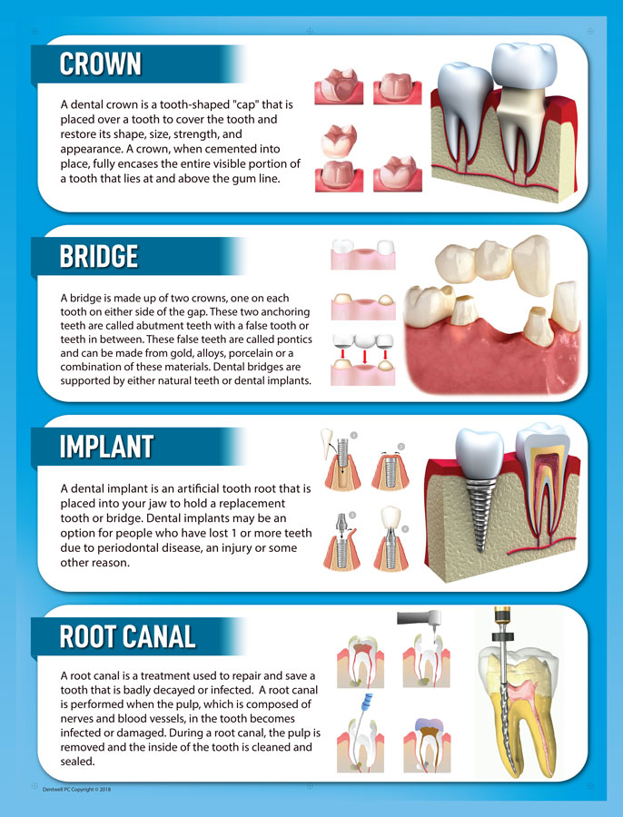 Is a Dental Crown the right dental treatment option for me in El Paso, TX? - Edgemere Dental
